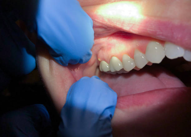 Best Emergency Root Canal Treatment in Albion, MI