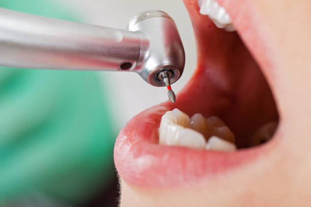 Best Broken or Cracked Tooth Emergency Dentist in Albion, MI